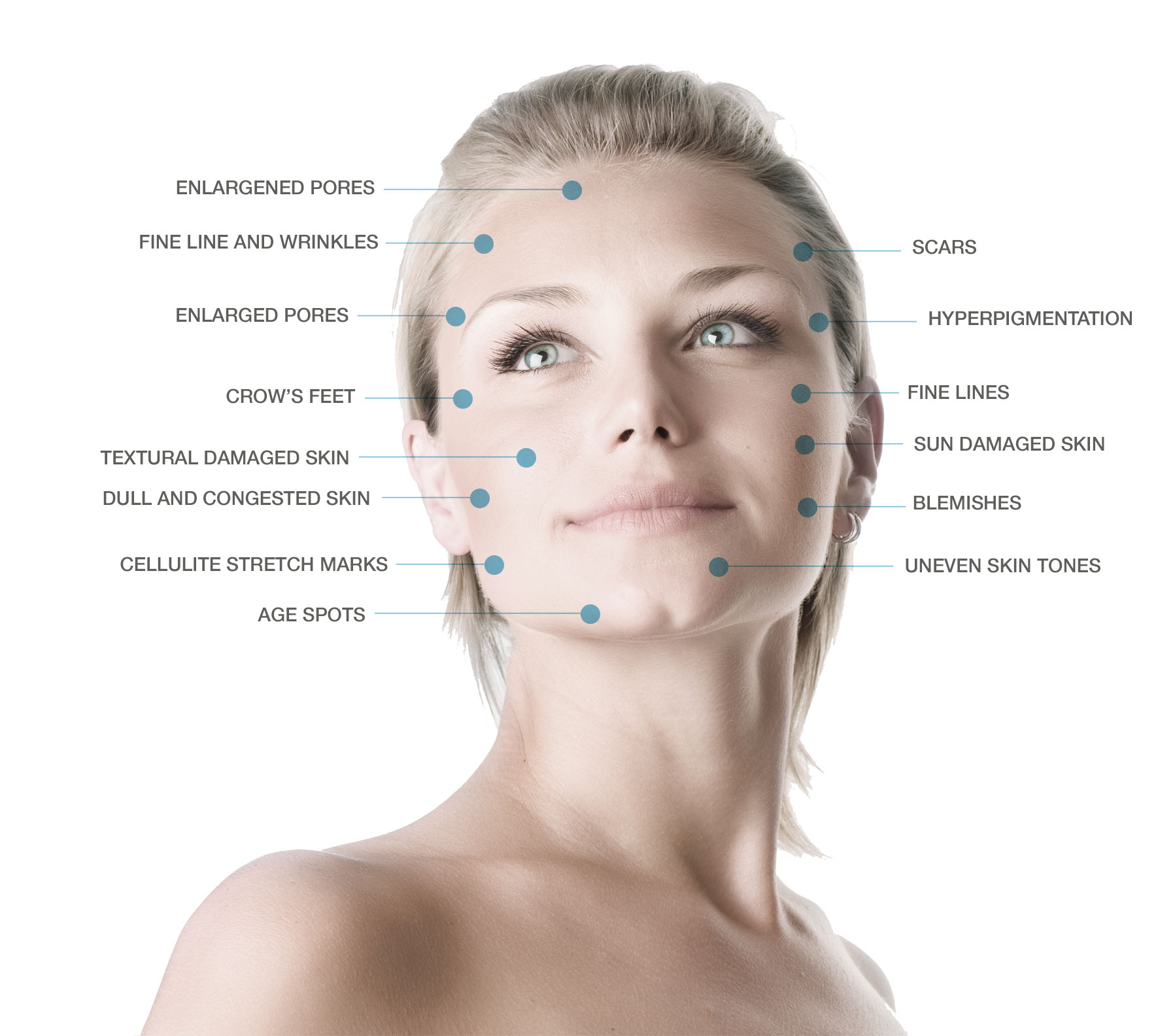 Microdermabrasion Dermesthetic Clinic