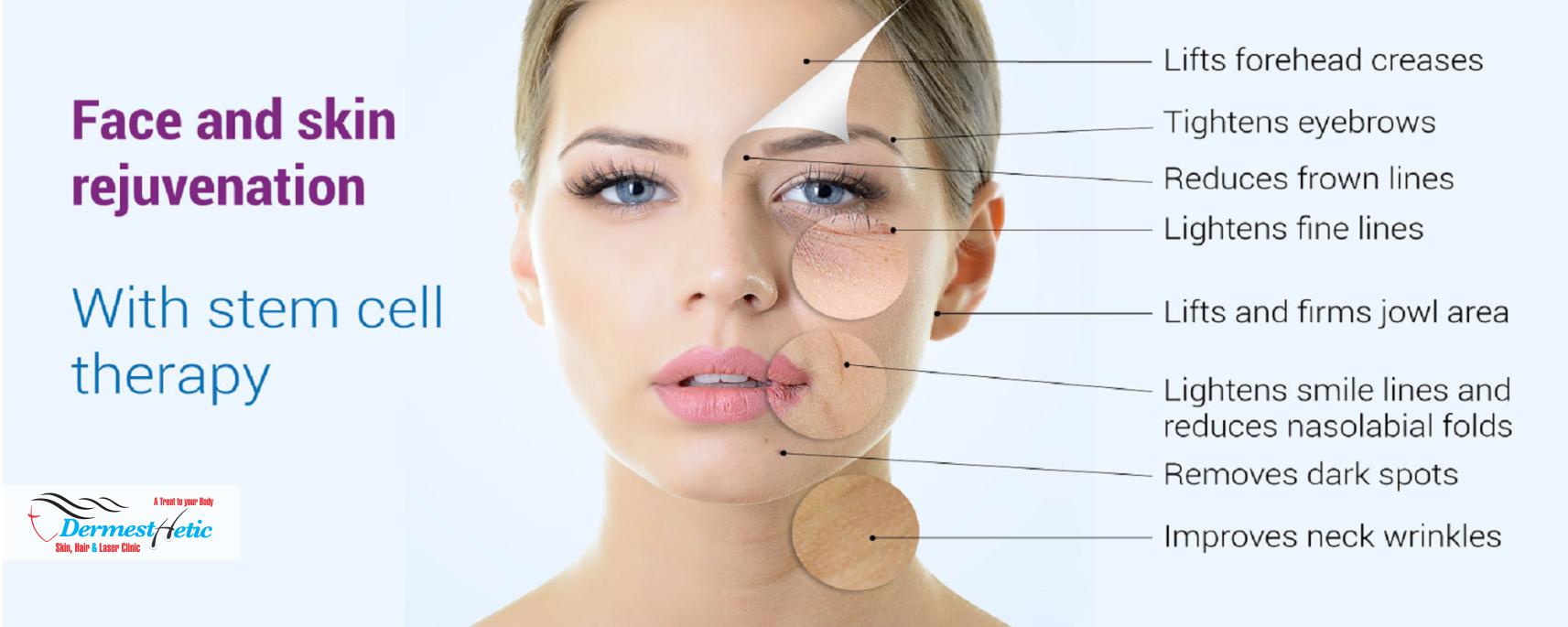 Stem Cells Therapy Dermesthetic Clinic