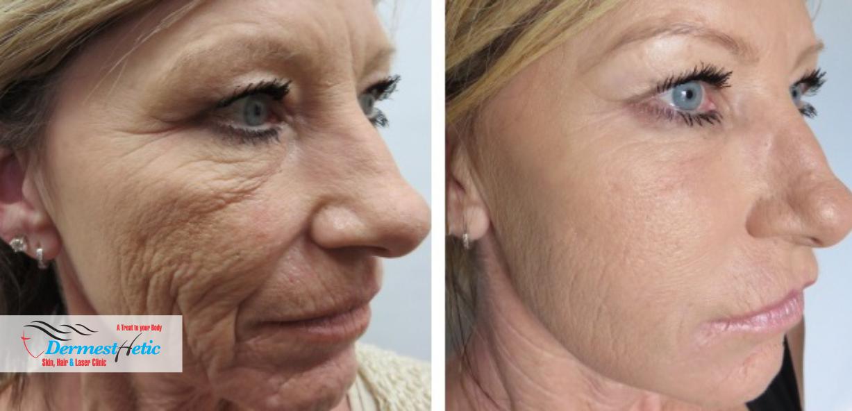 Stem Cells Therapy Dermesthetic Clinic